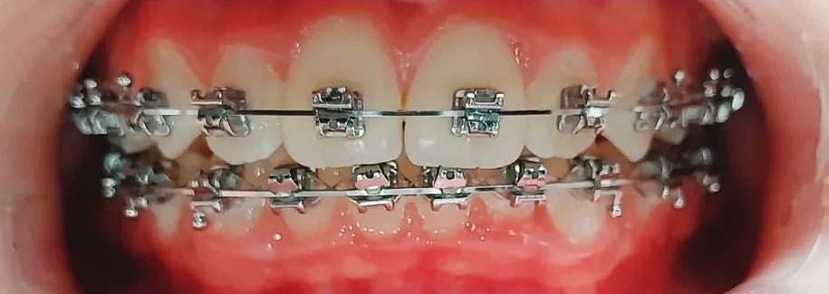 Prancheta 1 copiar 2