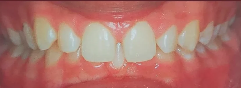 Prancheta 1 copiar 4