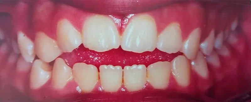 Prancheta 1 copiar 5